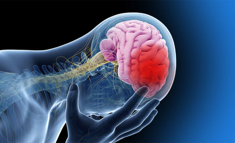 Accidente Cerebro Vascular